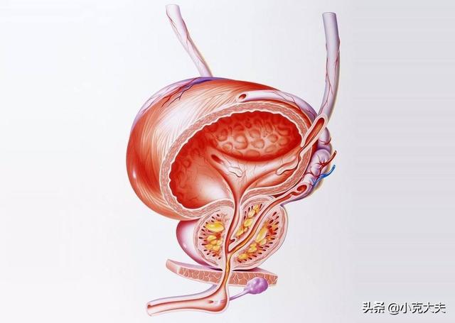 泌尿系统肿瘤:怎样确定是膀胱癌还是膀胱炎？