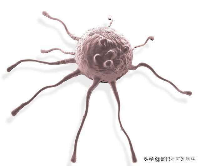 头条问答 - 癌细胞为什么要杀死人,人死了癌细胞不是也死了吗?