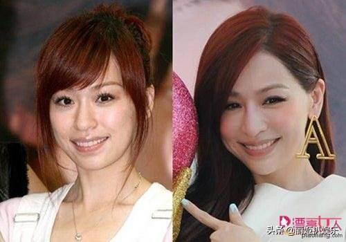 童菲整容前后:结婚以后，发现老婆是个人造美女，多处整形，你是什么感受？