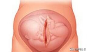 头条问答 手术后伤口愈合了 但是疤痕越来越大 是怎么回事 41个回答