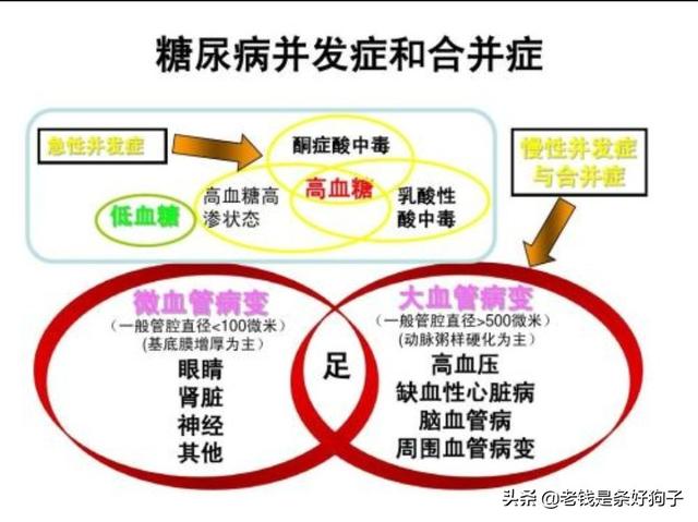 晚期糖尿病有什么症状:糖尿病晚期有些什么症状 提示糖尿病加重的危险信号有哪些？