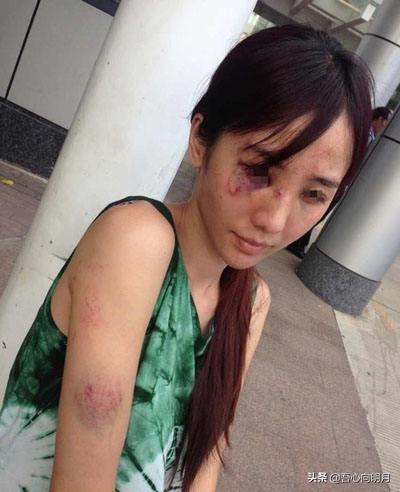 佟丽娅家暴:被家暴正确的选择是什么，是离婚？还是相信他会改？