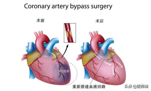 手术后的病症，手术后的病症病人是否一定要化疗