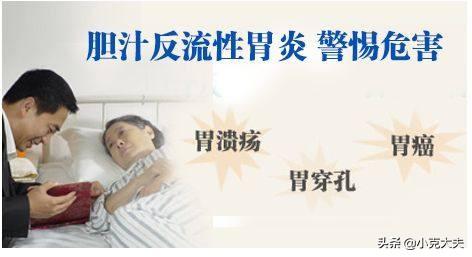 胆汁胃炎的症状及治疗:谁知道治疗胆汁反流性胃炎的药？