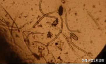 花叶芋根结线虫病:农村种植辣椒，应该如何防治病虫害？