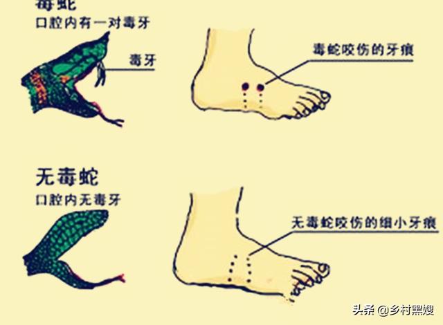 无毒蛇咬人吗:蛇咬人是出于一种什么心理？