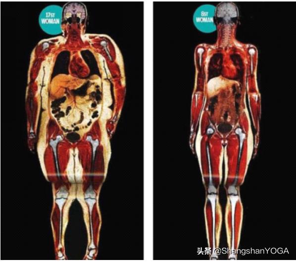 头条问答 体脂率26 应该是先减脂还是先健身 14个回答