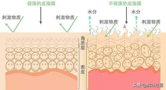 非离子洗面奶有哪些，哪些“洗面奶”成分特别刺激，用久了脸上痘痘，毛孔粗大严重呢