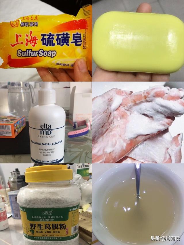 网上那些加微信免费祛痘的是真的吗？(网上加微信祛痘是真的吗)