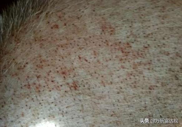 附红体病:刚买回来的后备母猪身上有红点，伴有咳嗽是什么原因？