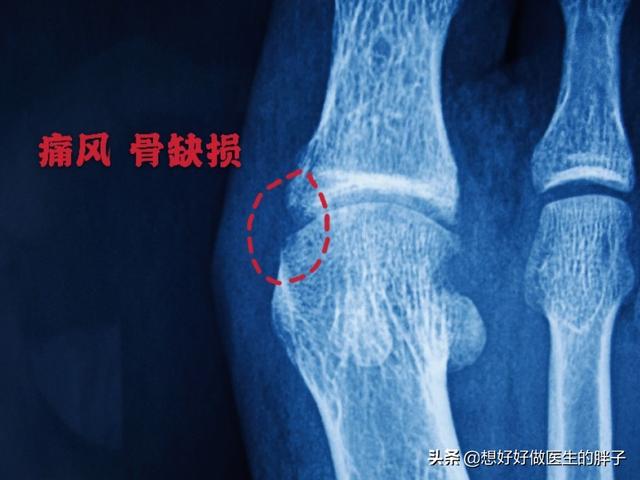 虎门软骨鲫鱼养殖基地:钓友们钓鱼时什么情况最郁闷？