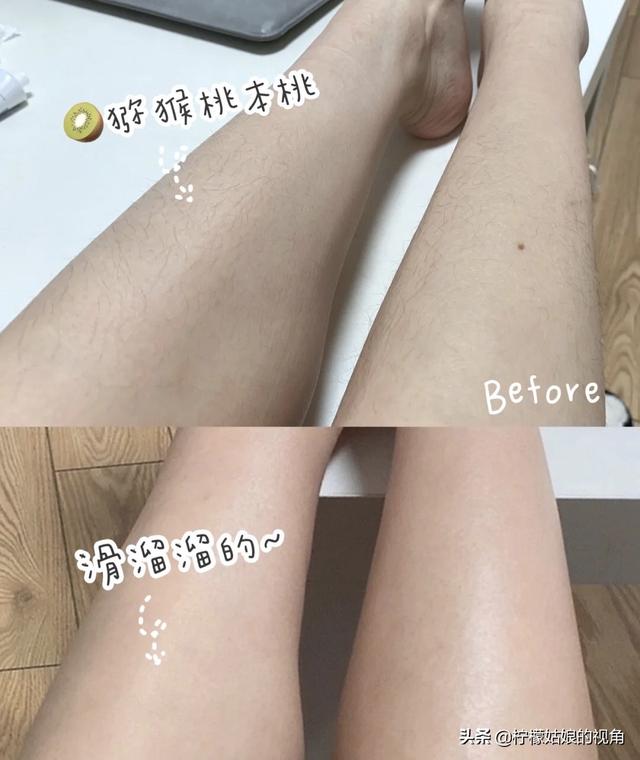 头条问答 家用的脱毛器是永久脱毛的吗 13个回答