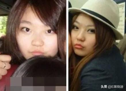周扬青曝整容原因:你会如何评价周扬青的长相？