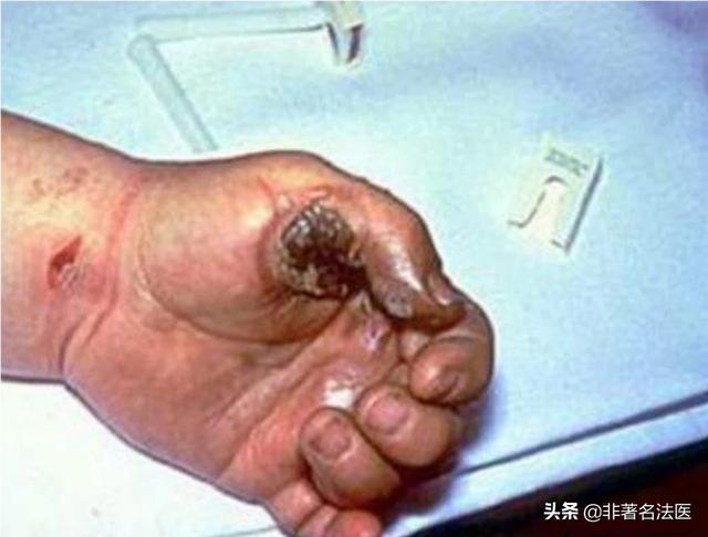 人触电后为什么会被吸住?该如何处理?-头条问答