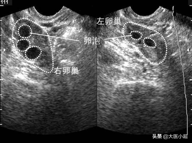 超声猫猫网:我家猫经常拉稀怎么办？医院检查不出来所以然？