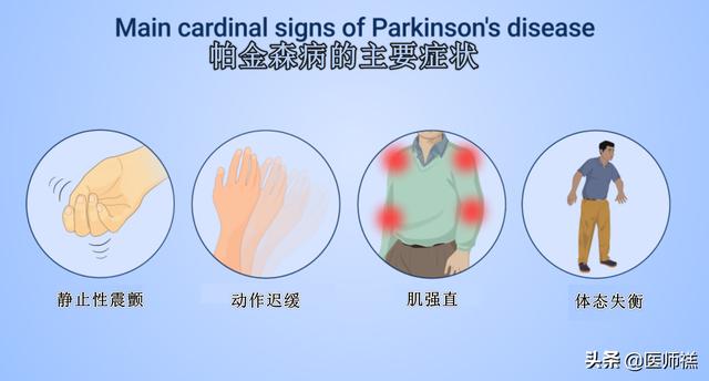 莱姆病症状早期以:帕金森综合症早期症状有哪些？