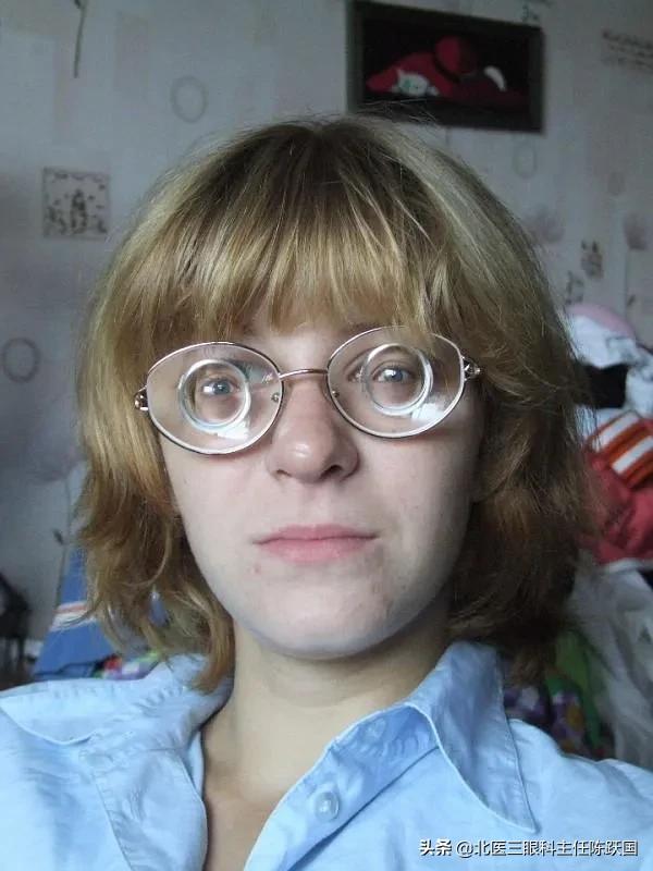 为什么有些人明明高度近视却依旧不戴眼镜