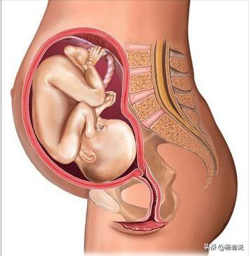 怀孕破水和漏尿如何区分，怀孕期间，尿特别多，有时候担心是羊水，该怎么分辨