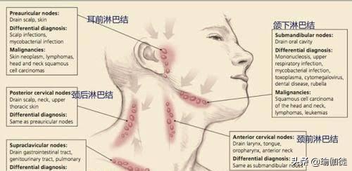 瑜伽狗:瑜伽中的骆驼式头部往后仰会不会使脸部变形？ 瑜伽狗式动作图片