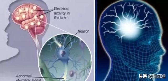 癫痫的症状:癫痫的症状有哪些 癫痫病表现出来的危害都有什么？