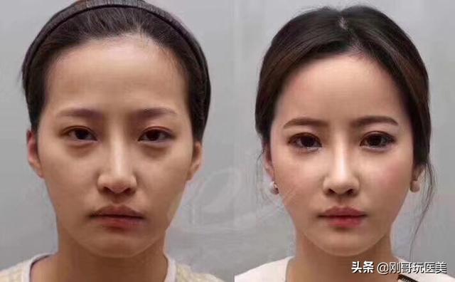 头条问答 你做整容后悔了吗 16个回答