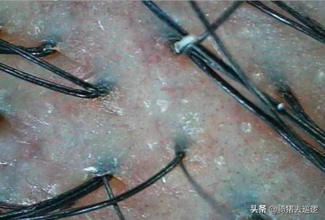 古代女子刑罚:古代女囚最害怕的“滴水刑”, 到底是什么样的刑罚