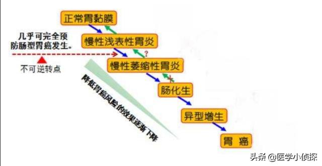 细螺旋病毒:幽门螺杆菌感染多久变胃癌，有什么东西可以有效清除它？