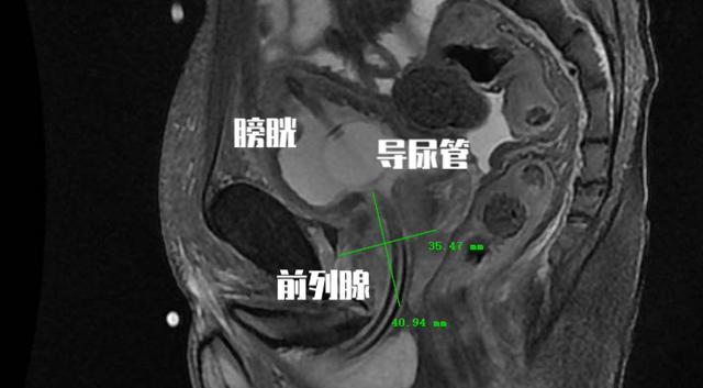 排尿困难:布偶猫排尿困难怎么回事？