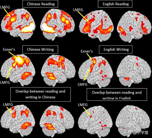 头条问答 - 说话由大脑的语言中枢控制吗?(1个回答)