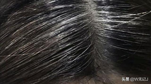 四十六岁的女人算进入老年了吗？插图25