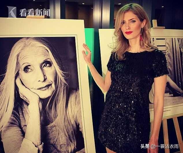 养狗这件事08下载:女模被领养的狗咬毁容险失明，指责收养所反被骂，你怎么看？