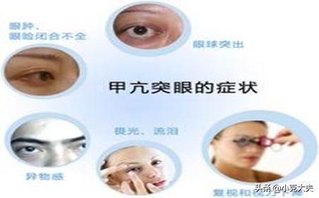 甲状腺机能亢进病:甲状腺功能亢进症危害有多大？