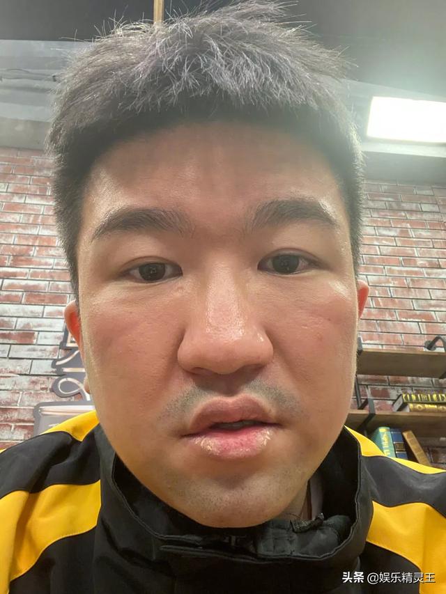 张大大抑郁症:如何评价张大大微博发文「不能被抑郁给打败」？