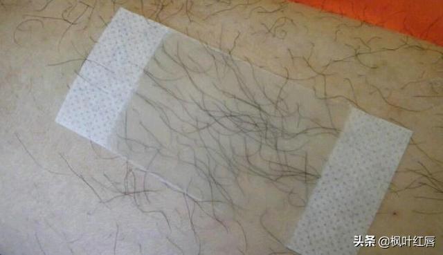 给b脱毛:非医美，哪种脱毛方法最好啊？