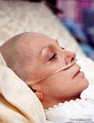 头条问答 - 乳腺癌晚期身体为什么没消瘦反而还微胖?(3个回答)