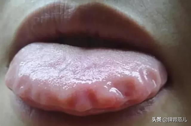 拉稀怎么办:猪出现腹泻拉稀的情况怎么办？ 拉稀怎么办什么方法最有效