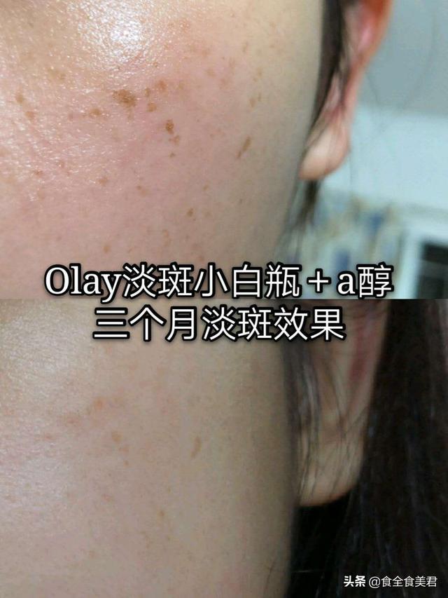 如何淡斑祛斑？
