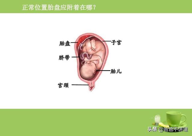 孕12周胎盘位于前壁  怀孕了，胎盘位于前壁会有
