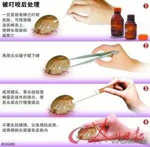 婢虫狗:如果蜱虫已经死了怎么拔出狗身上的蜱虫？