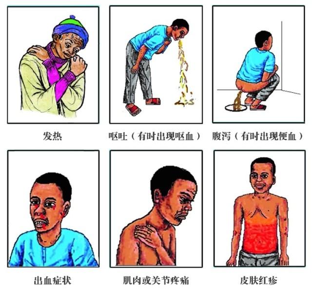 埃博拉吐内脏图:埃博拉病毒是什么，可怕在哪里