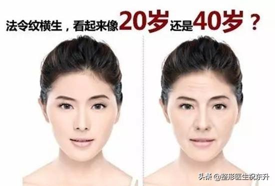 女生脸部护理小知识:女生脸上法令纹是什么？又该如何护肤抚平法令纹呢？