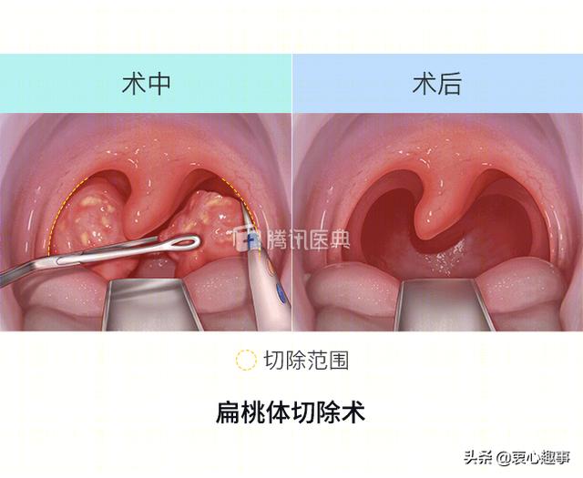 头条问答 