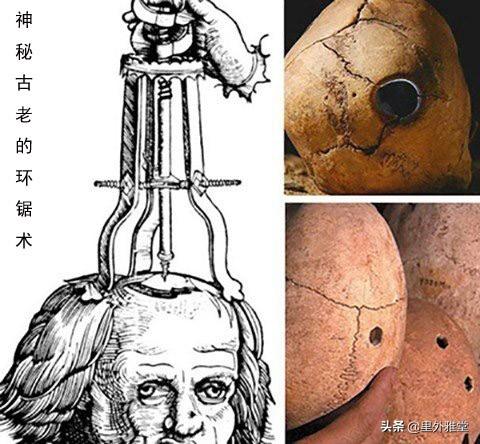 巫术咒语:祝由术（巫术）符咒语是怎么回事？