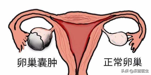 狗患唾液腺囊肿会死吗:眼镜蛇体内是剧毒，那么眼镜蛇互相咬中毒吗？