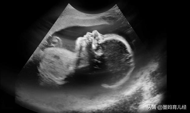 7个月的宝宝发育标准(三个月宝宝发育迟缓)