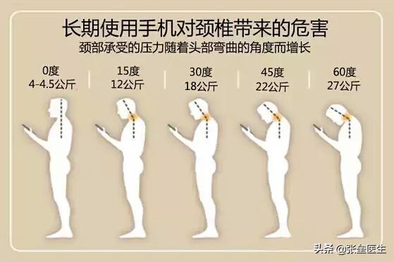 脊椎病的症状都有哪些:颈椎病的症状都有哪些 脊椎病会引起头痛头晕吗？