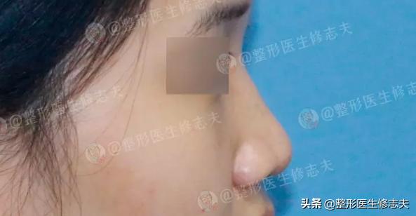 娜娜娜扎侧脸对比:为什么有人侧颜比正脸好看多了？