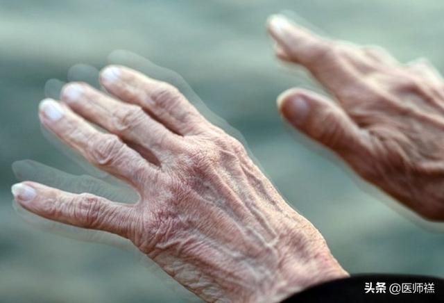 莱姆病症状早期以:帕金森综合症早期症状有哪些？
