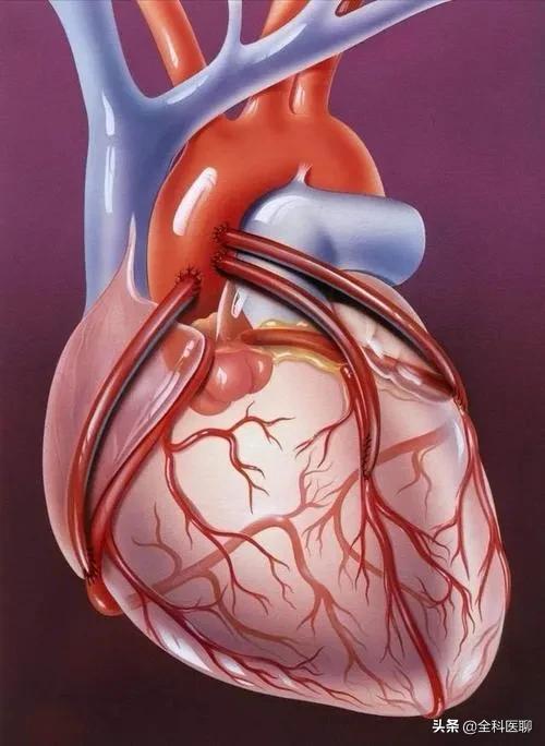 头条问答 心脏有三个主血管 堵了一两个能维持心脏正常运转吗 48个回答