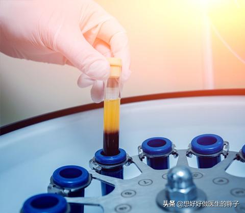 膝盖软骨磨损吃什么号:膝关节软骨磨损了能复原吗？怎么办？